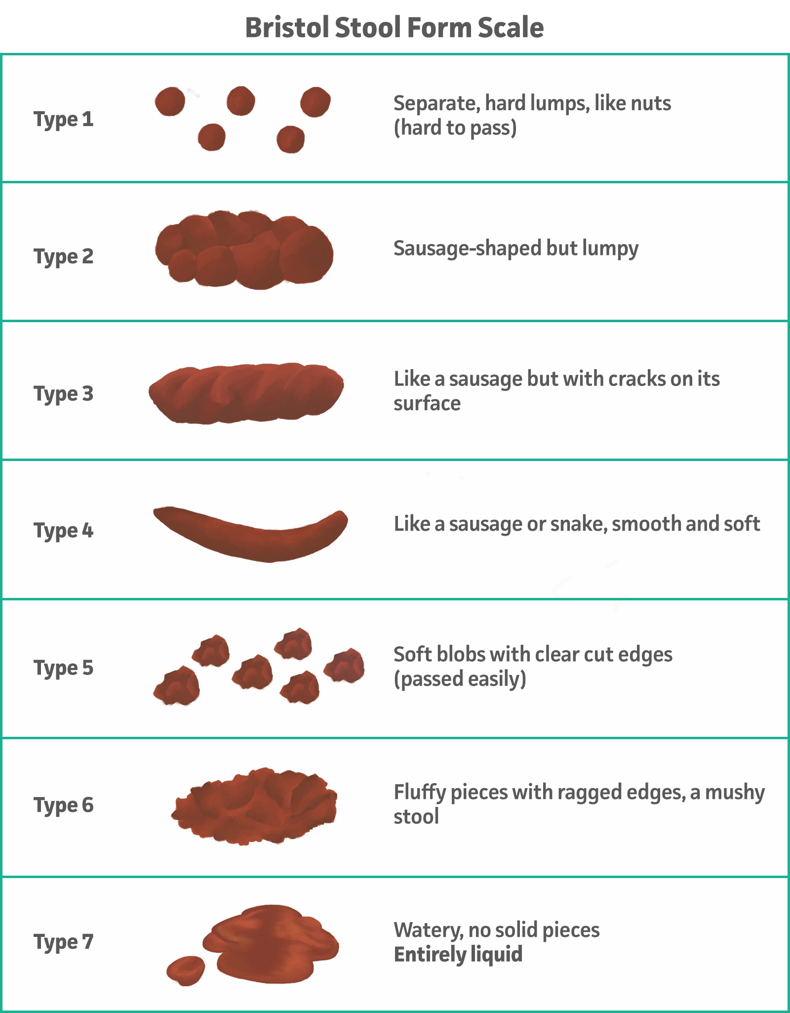 Bristol Stool Form Scale MDCalc