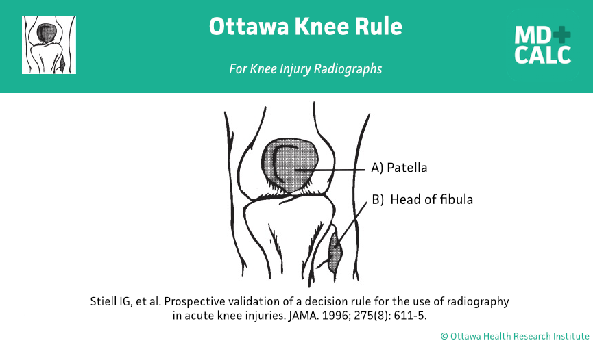 ottawa knee rule